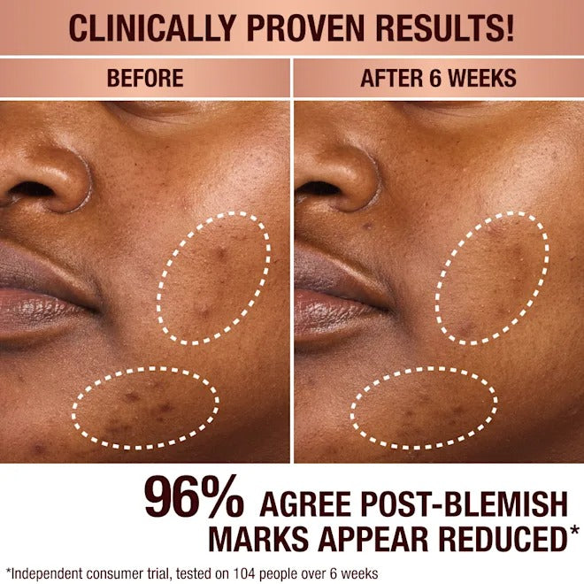 Tinh Chất Charlotte Tilbury Dark Spot Correcting Radiance Serum-Kallos