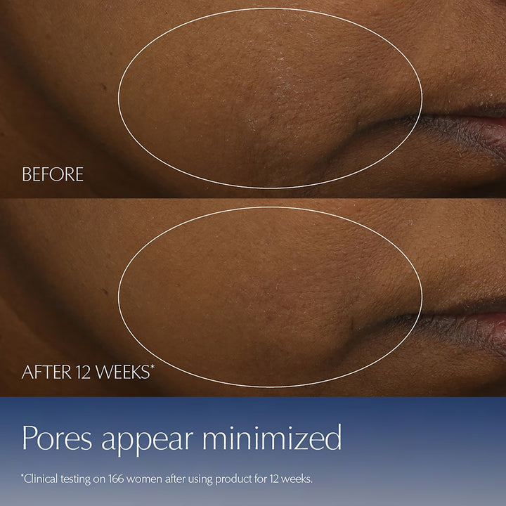 Tinh Chất ESTÉE LAUDER Advanced Night Repair Serum