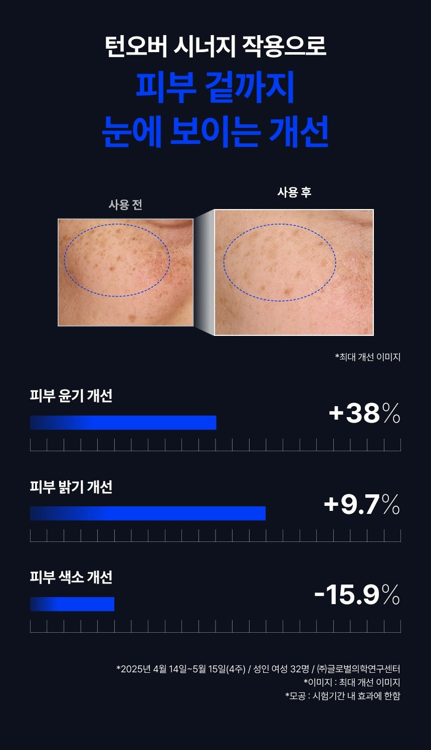 Tinh Chất IOPE Retinol Expert Retinol Retijection Serum