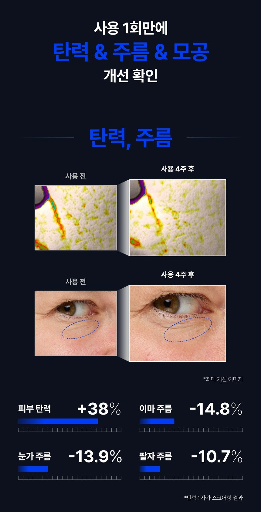 Tinh Chất IOPE Retinol Expert Retinol Retijection Serum