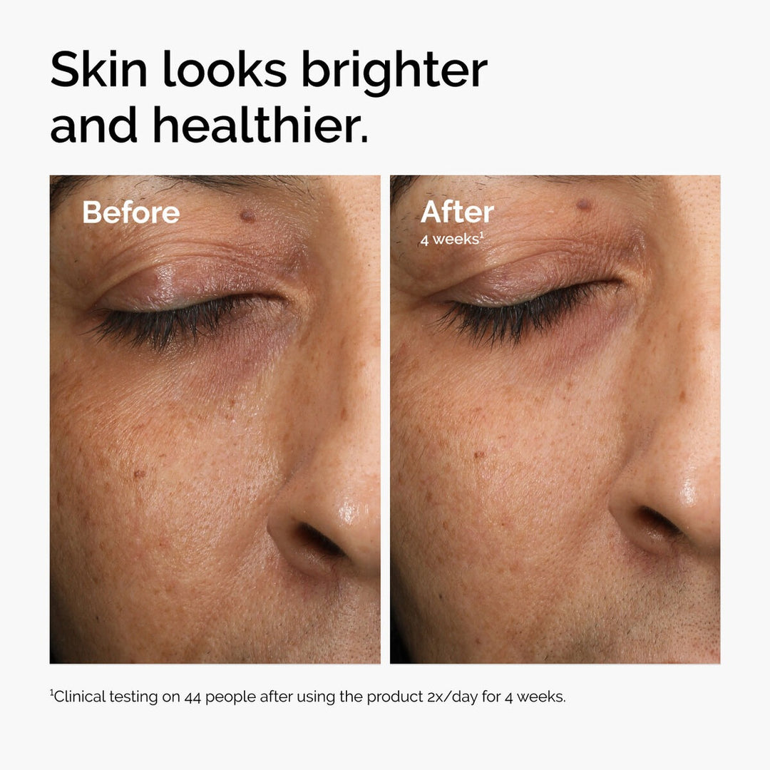 Tinh Chất The Ordinary Multi-Antioxidant Radiance Serum