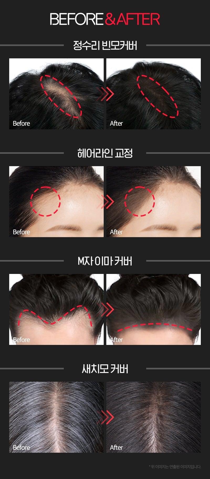 Che Khuyết Điểm Tóc RYO Hair Loss Care Hair Cushion - Kallos Vietnam