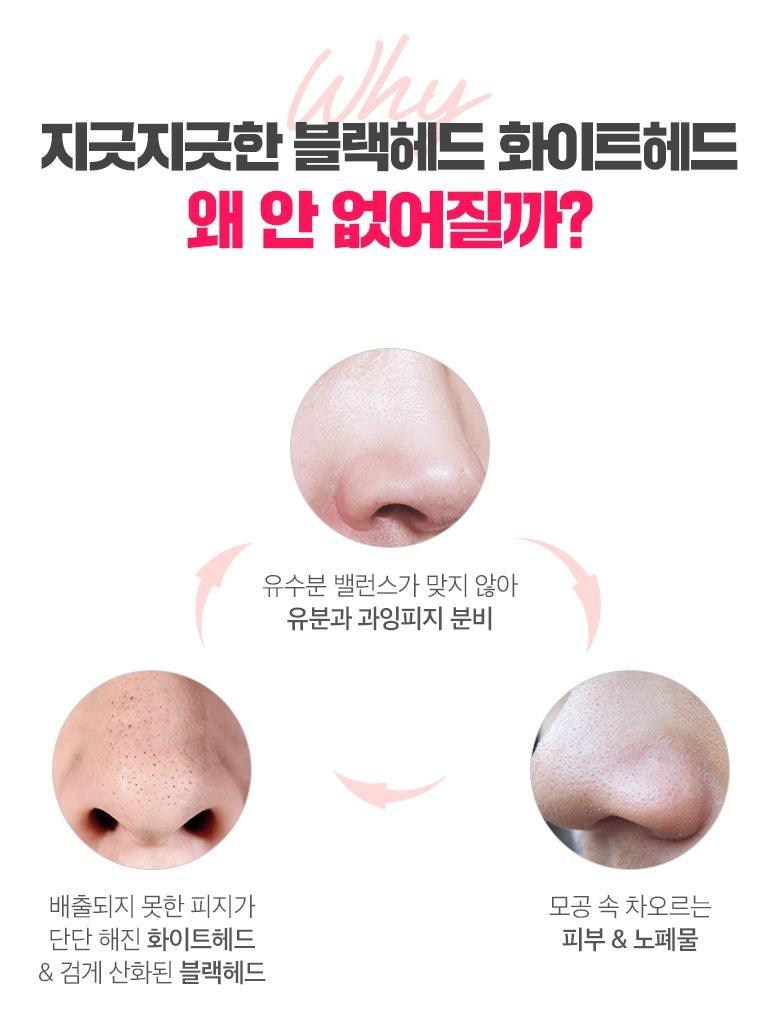 Lột Mụn MeFactory 3 Step Piggy Nose Strip - Kallos Vietnam