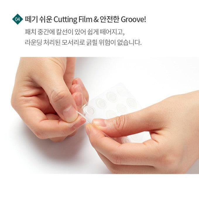 Miếng Dán Mụn Etude House Hydrocolloid Patch - Kallos Vietnam