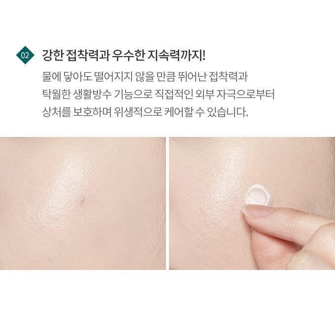 Miếng Dán Mụn Etude House Hydrocolloid Patch - Kallos Vietnam