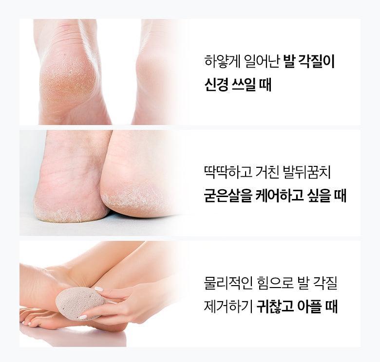 Tẩy Da Chân MeFactory Peeling Dead Foot Pack - Kallos Vietnam