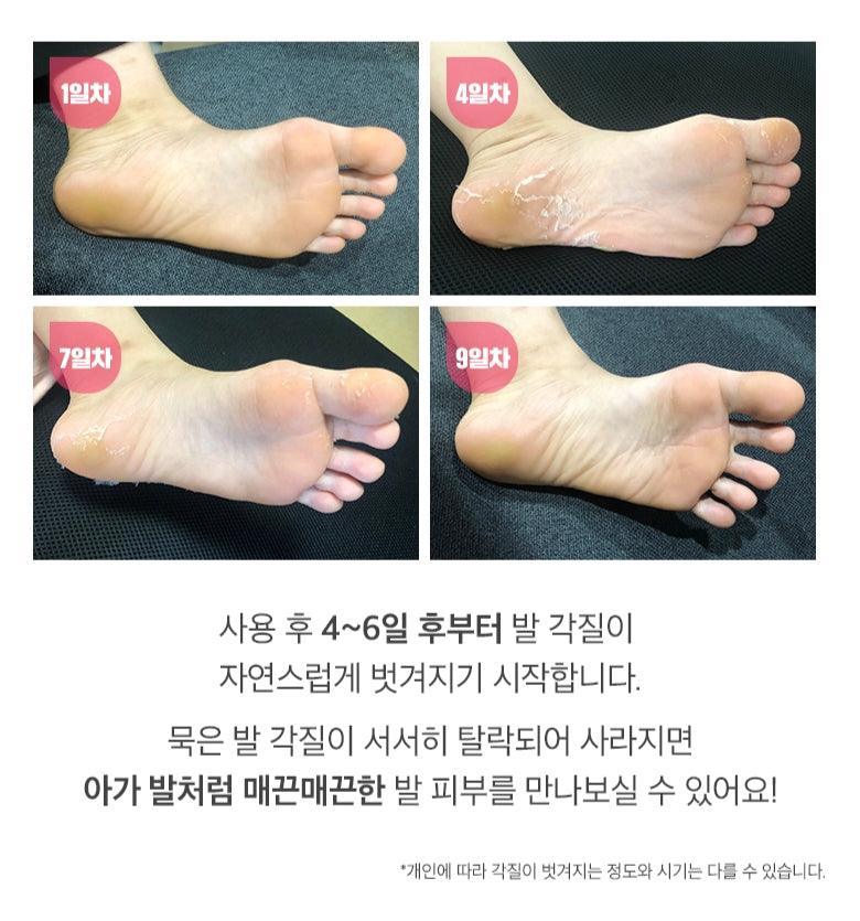 Tẩy Da Chân MeFactory Peeling Dead Foot Pack - Kallos Vietnam